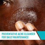 CeraVe Acne Treatment Face Wash – Salicylic Acid Cleanser for Acne & Pore Control